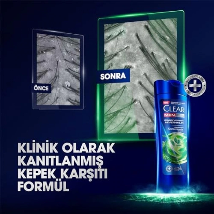 Kepeğe Karşı Şampuan 350 ml Günlük Kullanım İçin