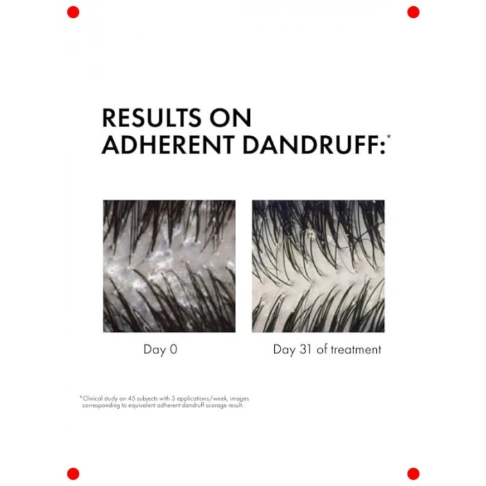 Kepek Karşıtı Bakım Şampuanı | Kuru Saçlar İçin | 390 ml