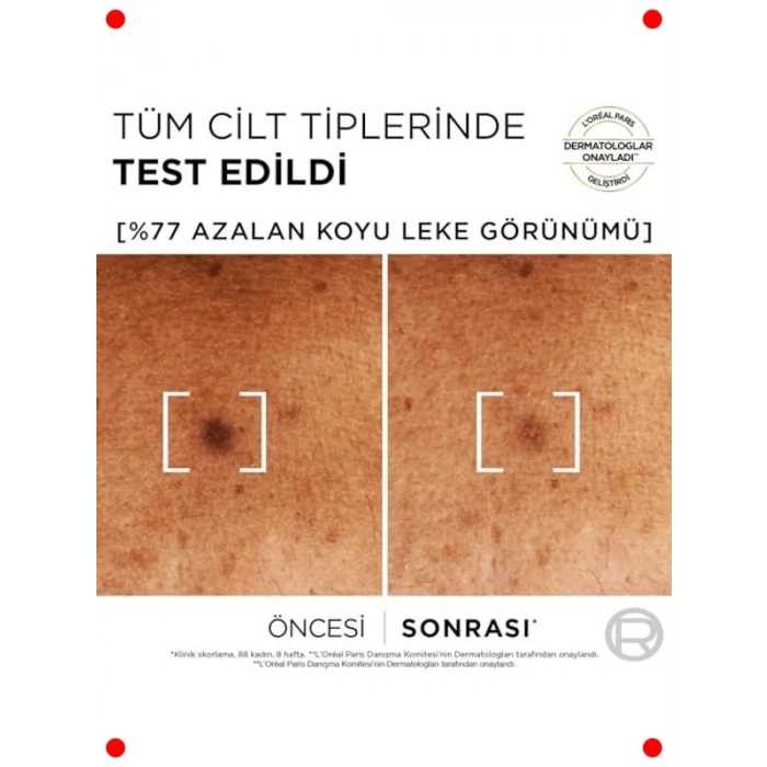 Koyu Leke Karşıtı Cilt Serumu - %10 Niasinamid (30ml)