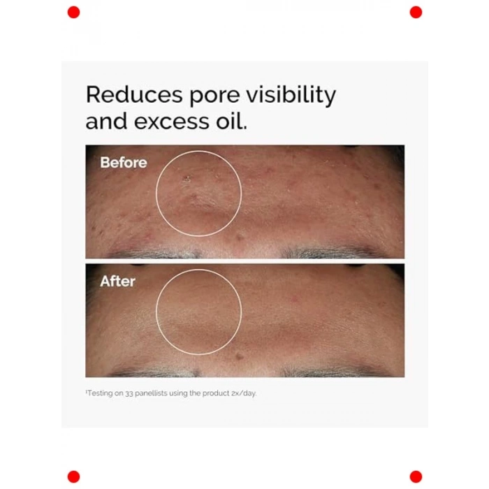 Niasinamid %10 + Çinko %1 Serum 30 ml