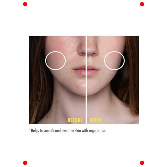 Niasinamid Destekli Cilt Serumu 30 ml