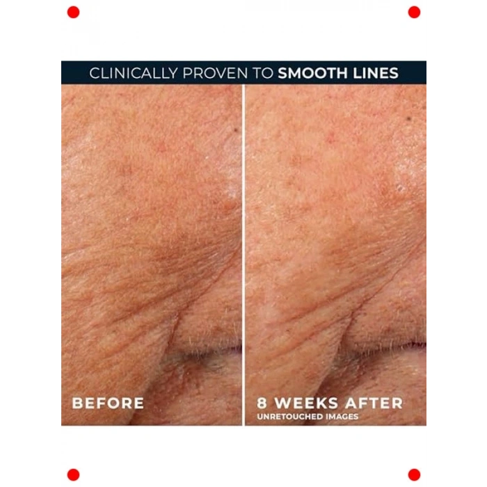 Retinol Kırışıklık Karşıtı Kapsül Serum (10 Adet)