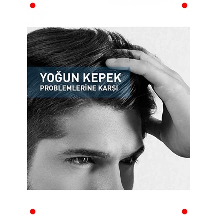 Yoğun Kepek Karşıtı Termal Etkili Şampuan 200ml