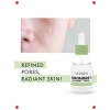 Niasinamid & Hyalüronik Asit Gözenek Sıkılaştırıcı Serum 30 ml
