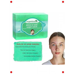 Doğal Akne ve Sivilce Karşıtı Sabun 140 Gr