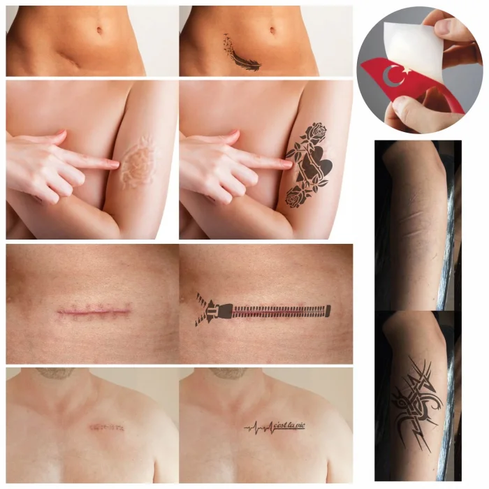 Yara Faça İzi Kapatma Dövme Şablonu Seti Kalp Fermuar