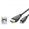 HDMI To Micro HDMI Kablo 1.5 Mt (HDX2007- Siyah)