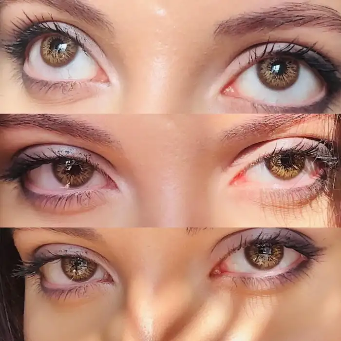 Zenith Hazel / Haresiz Doğal Ela / Renkli Lens Yıllık