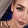 Retina Green / Hareli Yeşil Renkli Lens