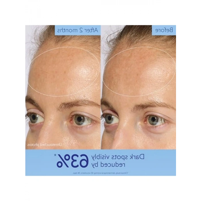 30 ml Işıltı Verici Leke Karşıtı Serum