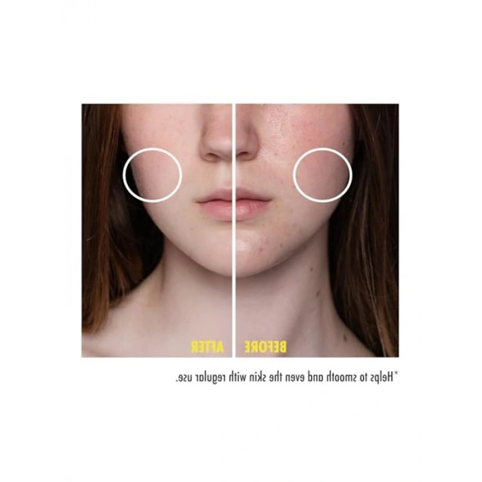 30 ml Niacinamide İçeren Cilt Serumu, Yenileyici Özellik