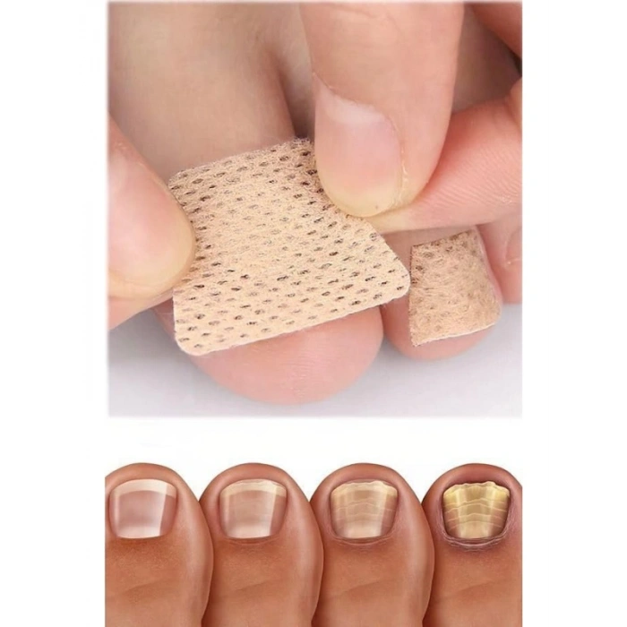 5 Çift Mantar Tırnak Yaması - Güçlü Tedavi