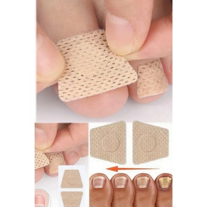 5 Çift Mantar Tırnak Yaması - Güçlü Tedavi