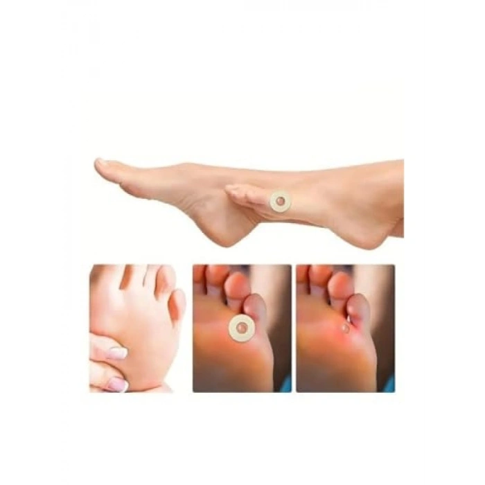 Ayak Nasır Bandı - Sünger Parmak Taban Yama Bant (15 Adet)