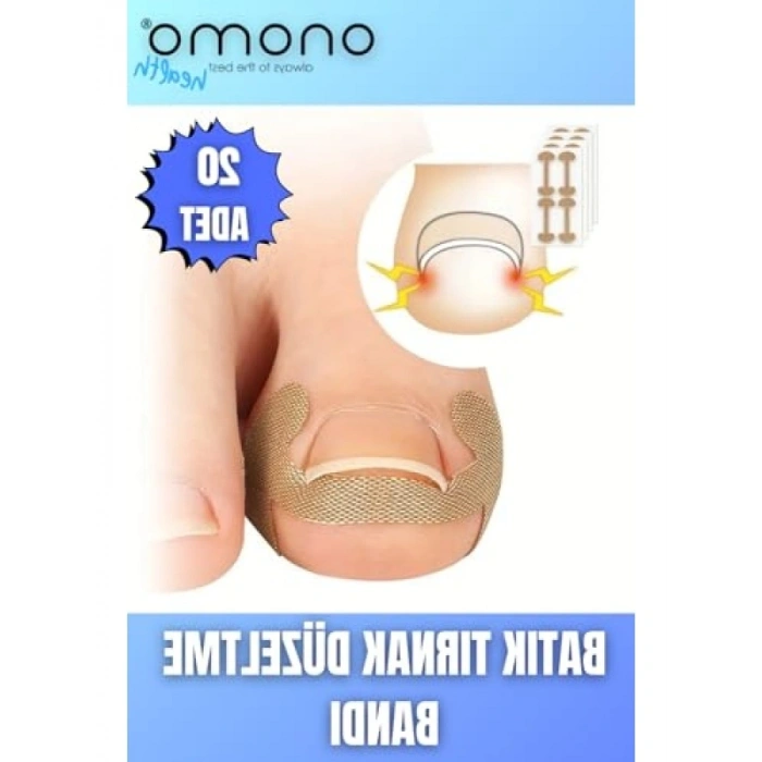 Batık Tırnak Düzeltme Bandı 20 Adet