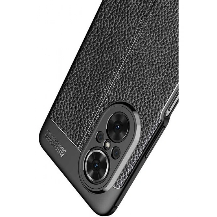 Case 4U Huawei Nova 9 SE Kılıf Rugan Armor Deri Görünümlü Yüksek Kalite Silikon Niss Siyah