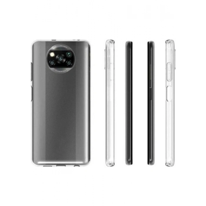 Case 4U Xiaomi Poco X3 / Poco X3 Pro Kılıf A+ Şeffaf Lüx Süper Yumuşak 0.3mm Ince Slim Silikon