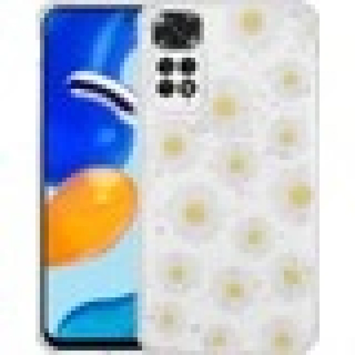 Case 4U Xiaomi Redmi Note 11 / 11s Kılıf Simli Desenli Kamera Korumalı Parlak Popy Kapak Kulübe Renkli