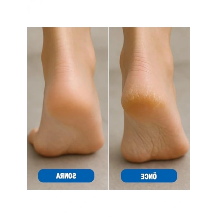 Çift Taraflı Paslanmaz Çelik Ayak Törpüsü