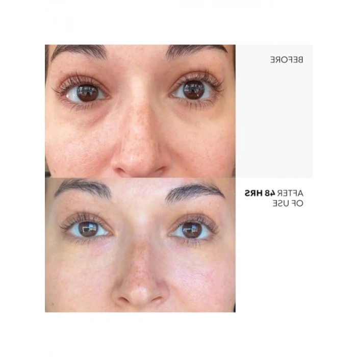 Gözenek Kontrol Kremi - 55g