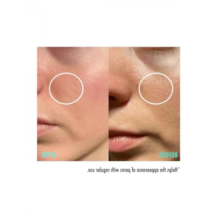Gözenek Sıkılaştırıcı Cilt Serumu - 30 ml