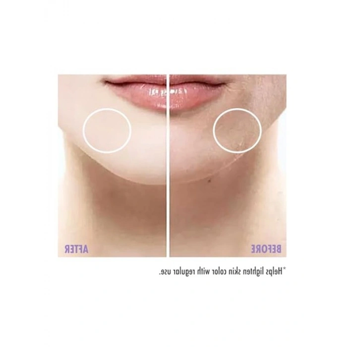 Leke Karşıtı Cilt Beyazlatıcı Krem, 200 ml, Etkili Formül