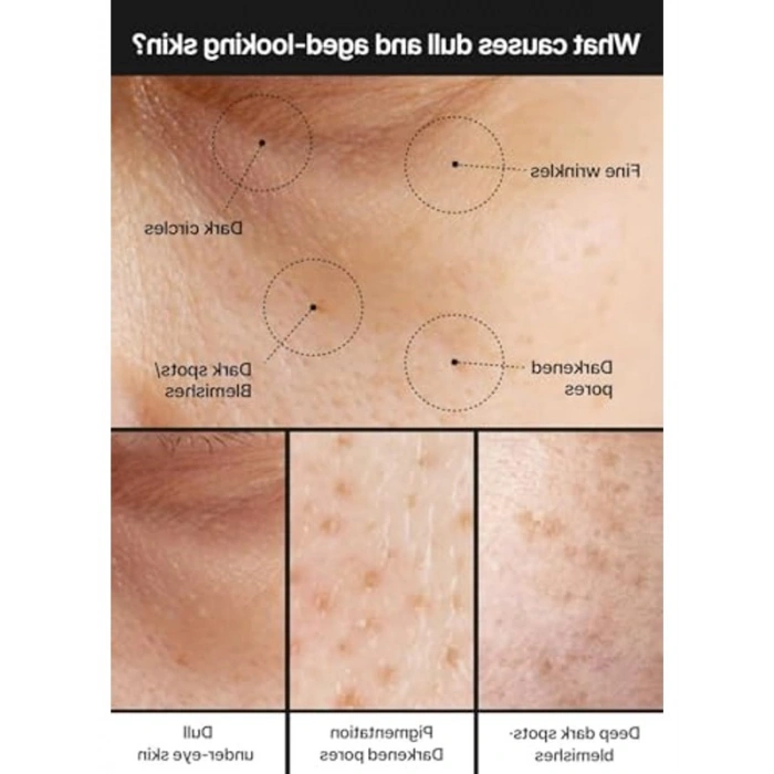Leke Karşıtı Krem, 35ml Boyutunda Cilt Aydınlatıcı Özellik