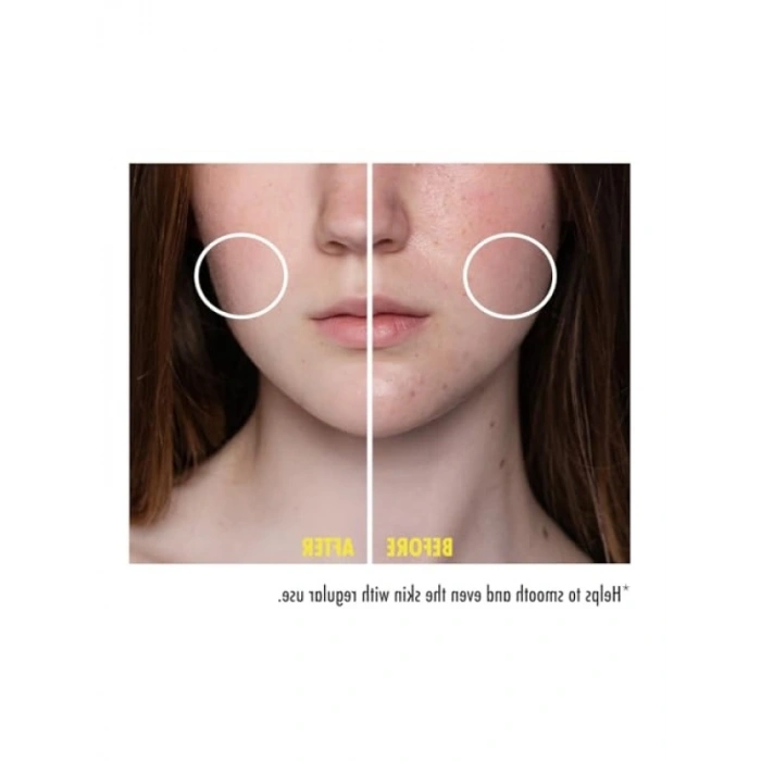 Niacinamide İçeren Cilt Serumu - 30 ml