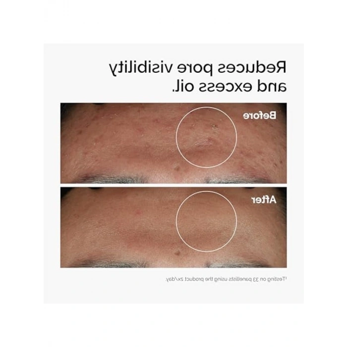 Niacinamide ve Çinko İçeren Serum, 30ml ile Cilt Bakımına Destek Sağlar