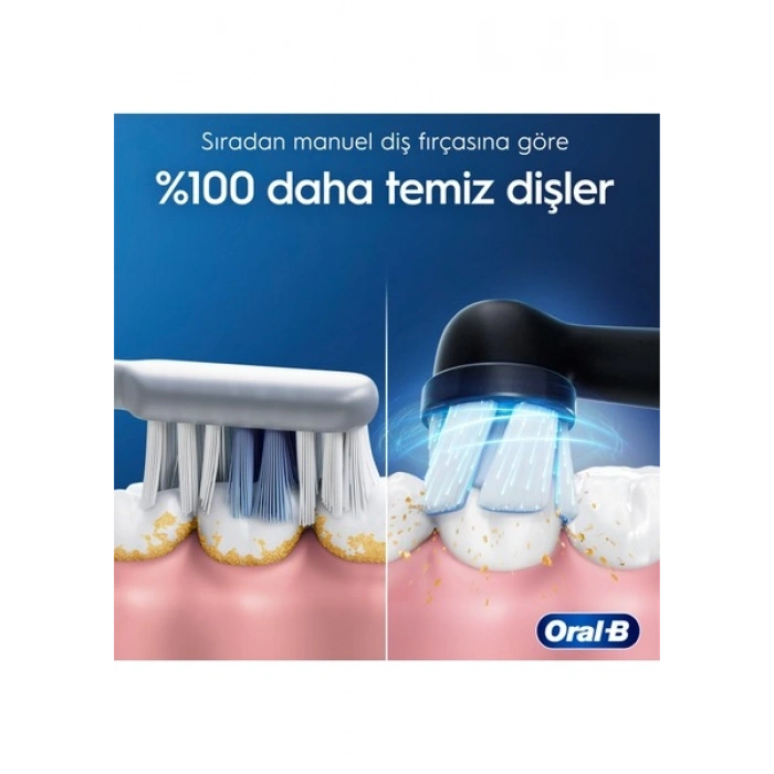 Oral-B iO 2 Şarjlı Diş Fırçası – Gece Siyahı