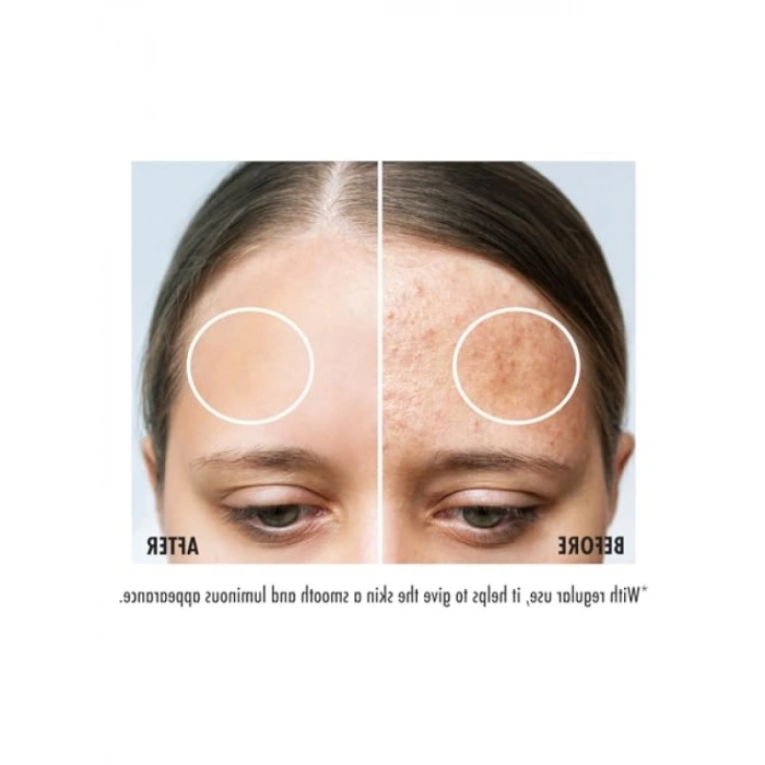 Peeling Etkili Glikolik Asit Tonik - 250 ml