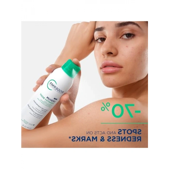 Sivilce ve Akne Lekesi Karşıtı Vücut Spreyi, 150 ml, Ferahlatıcı