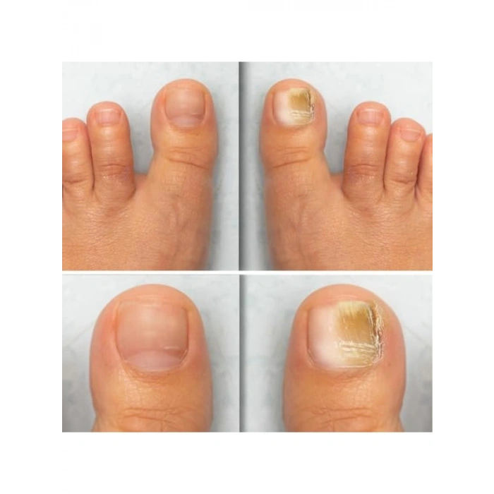 Yoğun Besleyici Tırnak Bakım Serumu