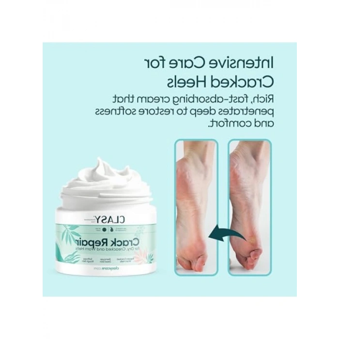 Yoğun Nemlendirici Ayak Kremi, E Vitamini ve Avokado Yağı ile, 100 ml