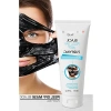 75 ml Soyulabilir Siyah Arındırıcı Maske