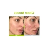 Azelaik Asit ve Kojik Asit İçeren Serum, Cilt Bakımı için Özel
