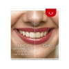 Beyazlatıcı Diş Macunu 50 ml | Aktif Oksijen Teknolojisi ile