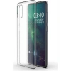 Case 4U Galaxy A51 Kılıf A+ Şeffaf Lüx Süper Yumuşak 0.3mm Ince Slim Silikon