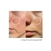 Gözenek Sıkılaştırıcı Cilt Serumu - 30 ml