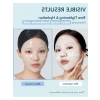 Hyaluronic Hydrogel Yüz Maskesi - 34g