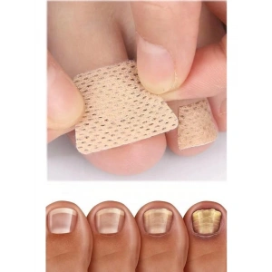 5 Çift Mantar Tırnak Yaması - Güçlü Tedavi