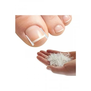 Batık Tırnak Düzeltici Şeritler - 10 Adet