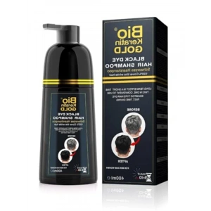 Siyah Boya Şampuanı, Beyaz Kapatıcı ve Hızlı Etki 400 ml