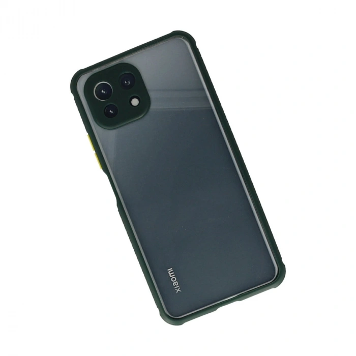 Xiaomi Mi 11 Lite Kılıf Miami Şeffaf Silikon - Koyu Yeşil
