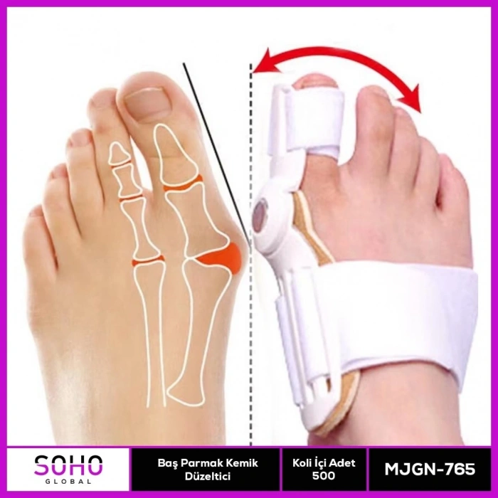 Baş Parmak Kemik Düzeltici Aparat