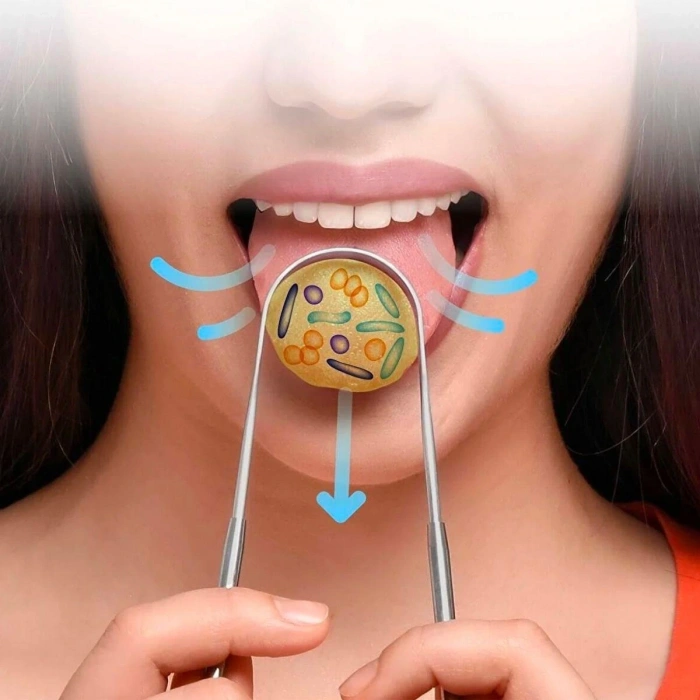 Dil Temizleme Dil Sıyırıcı Ve Temizleme Aparatı (5324)