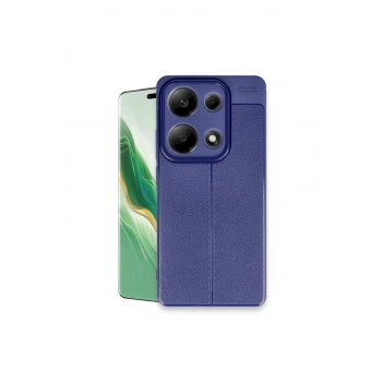 Redmi Note 13 Pro 4g Kılıf Auto Focus Kapak - Lacivert