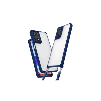 Redmi Note 11 Pro Kılıf Penta Silikon Kılıf - Lacivert