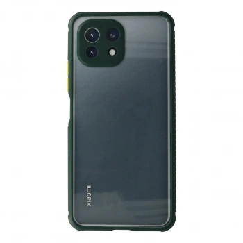Xiaomi Mi 11 Lite Kılıf Miami Şeffaf Silikon - Koyu Yeşil