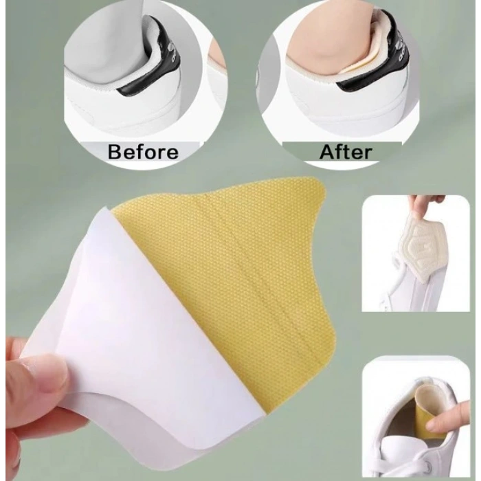 Taç Şekilli 10 mm Topuk Daraltma ve Vurma Önleyici (5047)